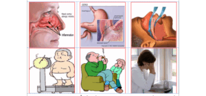 Cá thể hóa điều trị hen suyễn