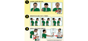 Kỹ thuật lấy đờm làm xét nghiệm đạt chất lượng