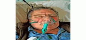 10 dấu hiệu cảnh báo đợt cấp COPD