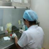 Soi đờm trực tiếp dưới kính hiển vi tìm trực khuẩn lao tại phòng khám Phổi Việt