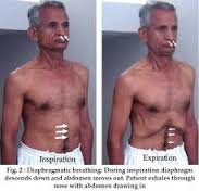 Thở cơ hoành cho bệnh nhân COPD