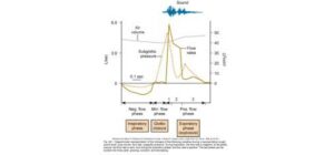 Sử dụng thuốc giảm ho – Long đàm – Tiêu đàm